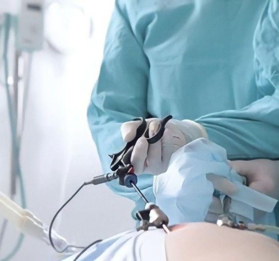 Minimal Access Surgeries