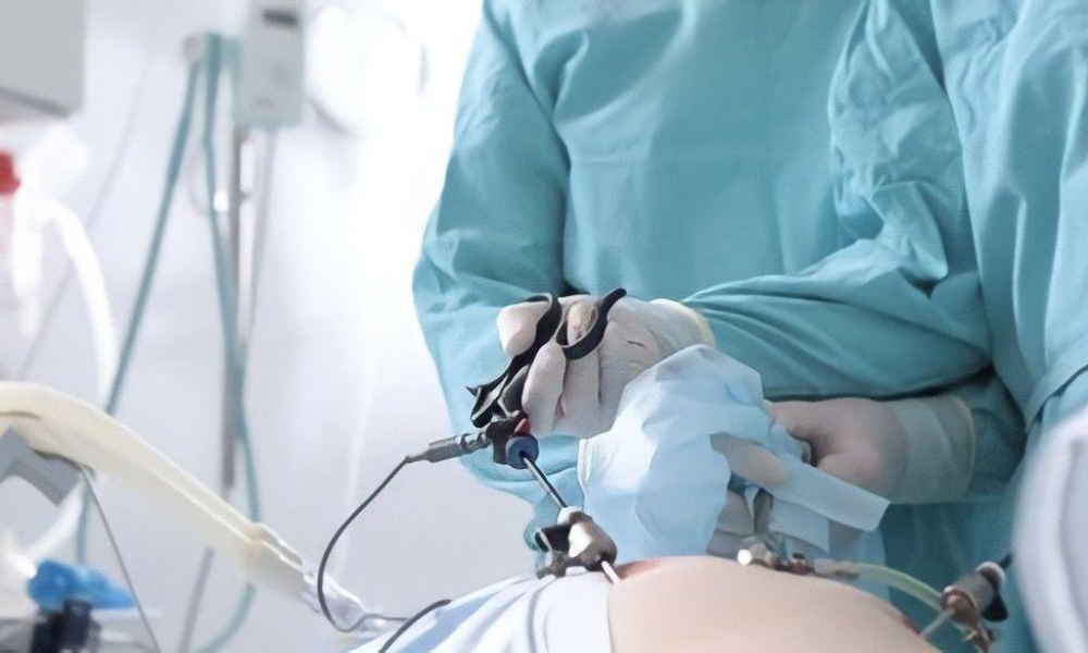 Minimal Access Surgeries